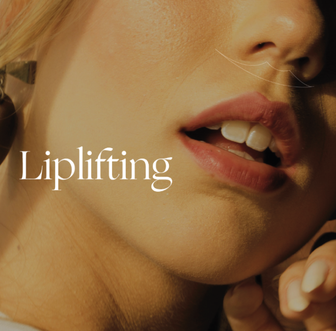 Tudo sobre Lip-Lifting!